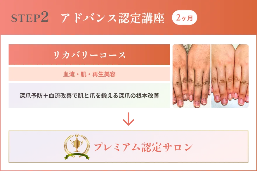 リプロネイル®式深爪矯正 アドバンス認定講座