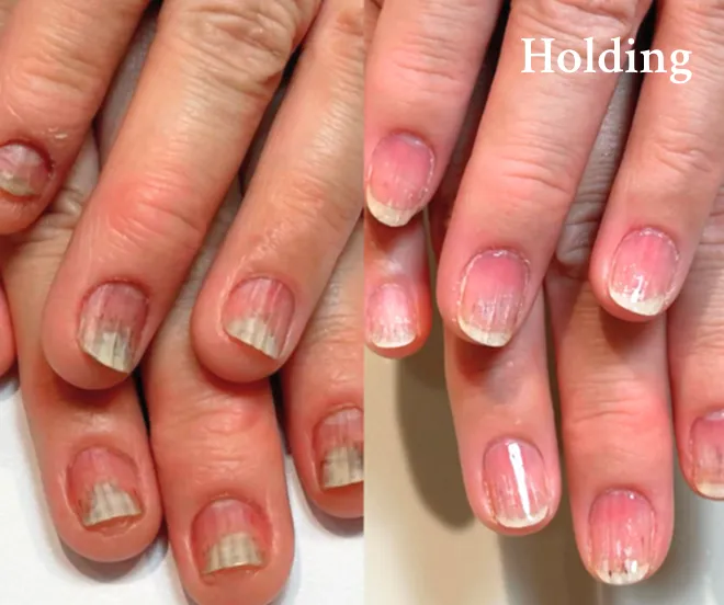 再発防止・保定・育成