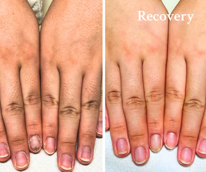 血流・肌・再生美容