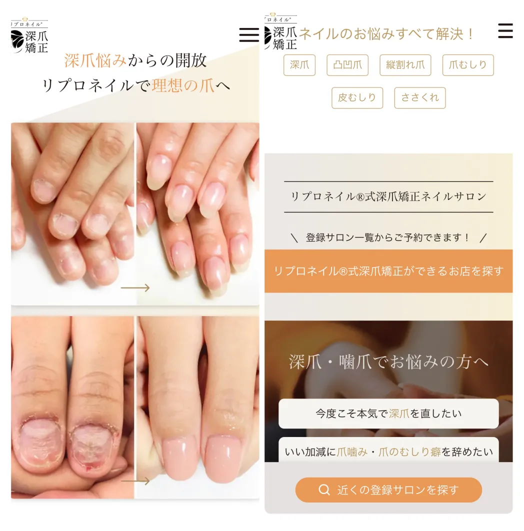 リプロネイル®ポータルサイト掲載イメージ