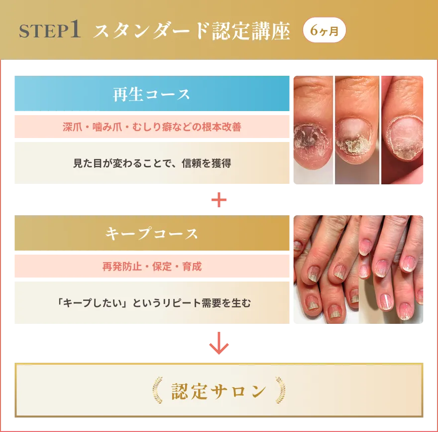 リプロネイル®式深爪矯正 スタンダード認定講座