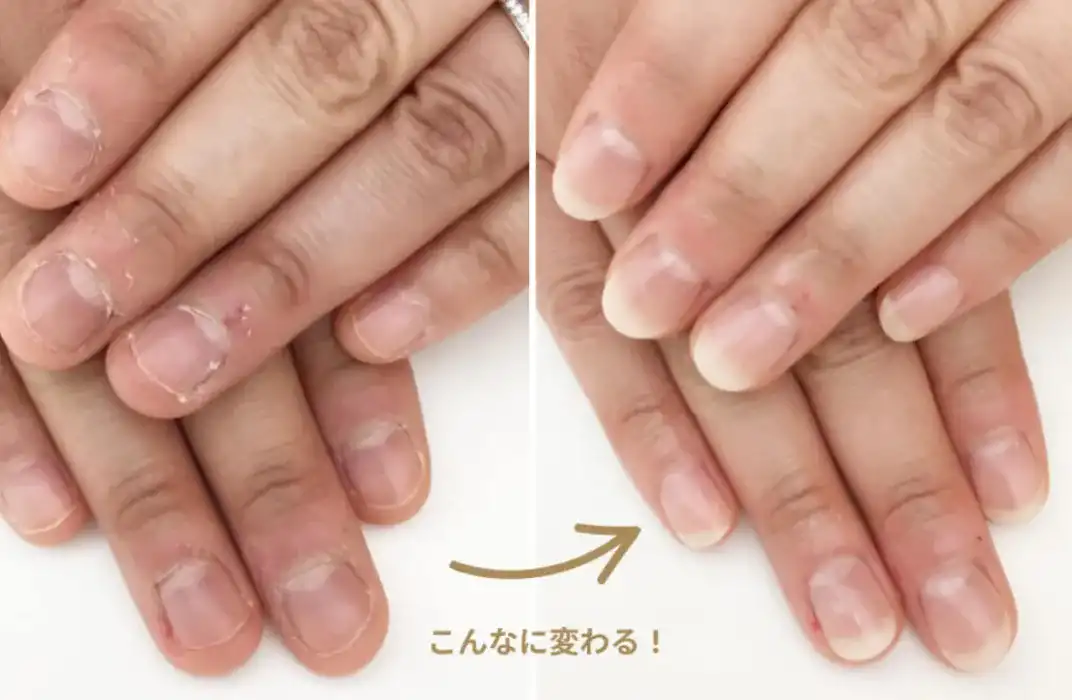 重度の深爪も“その日”に見た目が変わる！高単価でも指名される技術