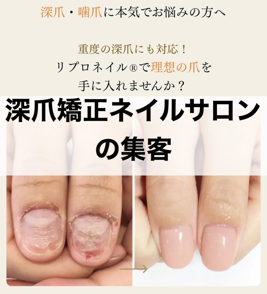 深爪矯正ネイルサロンの集客