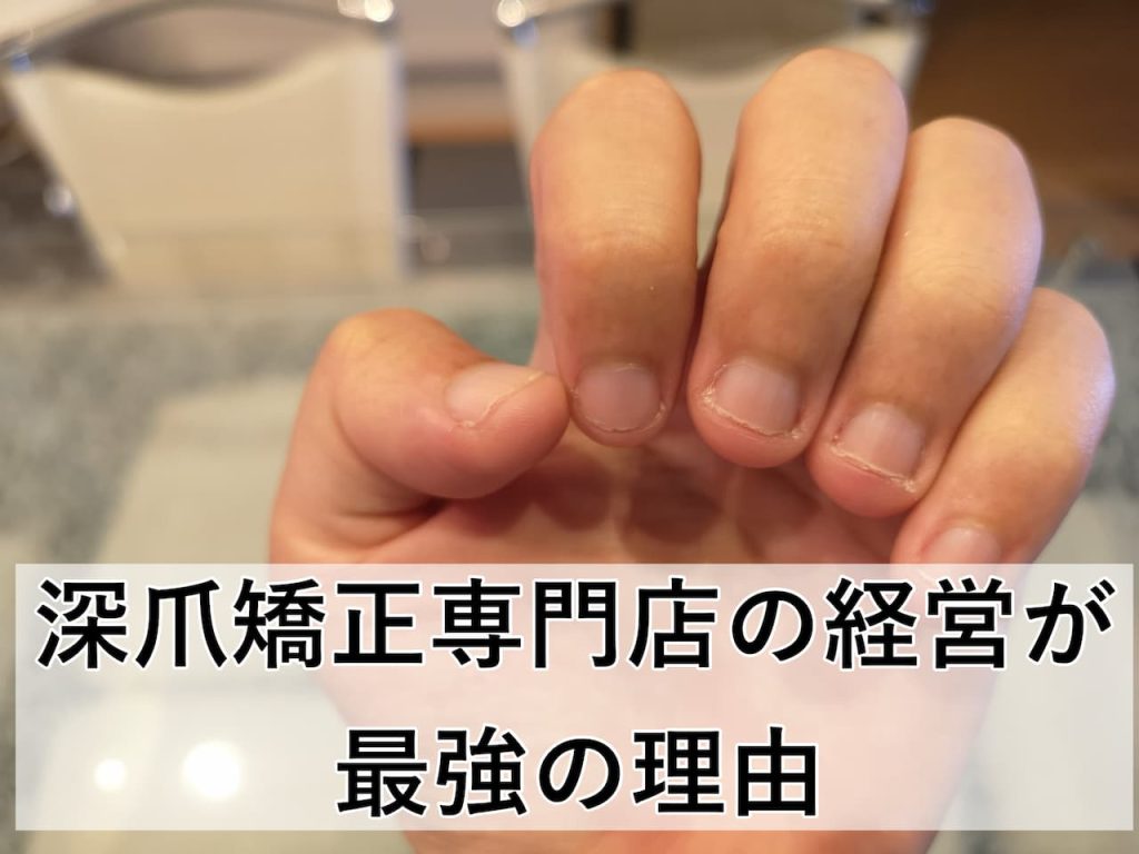 深爪矯正ネイルサロンの経営が最強の理由