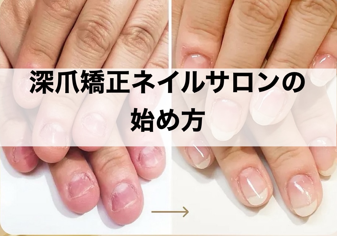 【必読】深爪矯正ネイルサロンの始め方