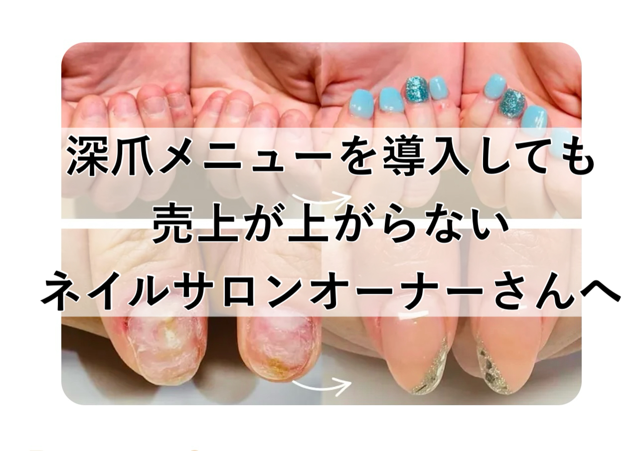 深爪メニューを導入しても売上げが上がらないネイルサロンオーナーは必見