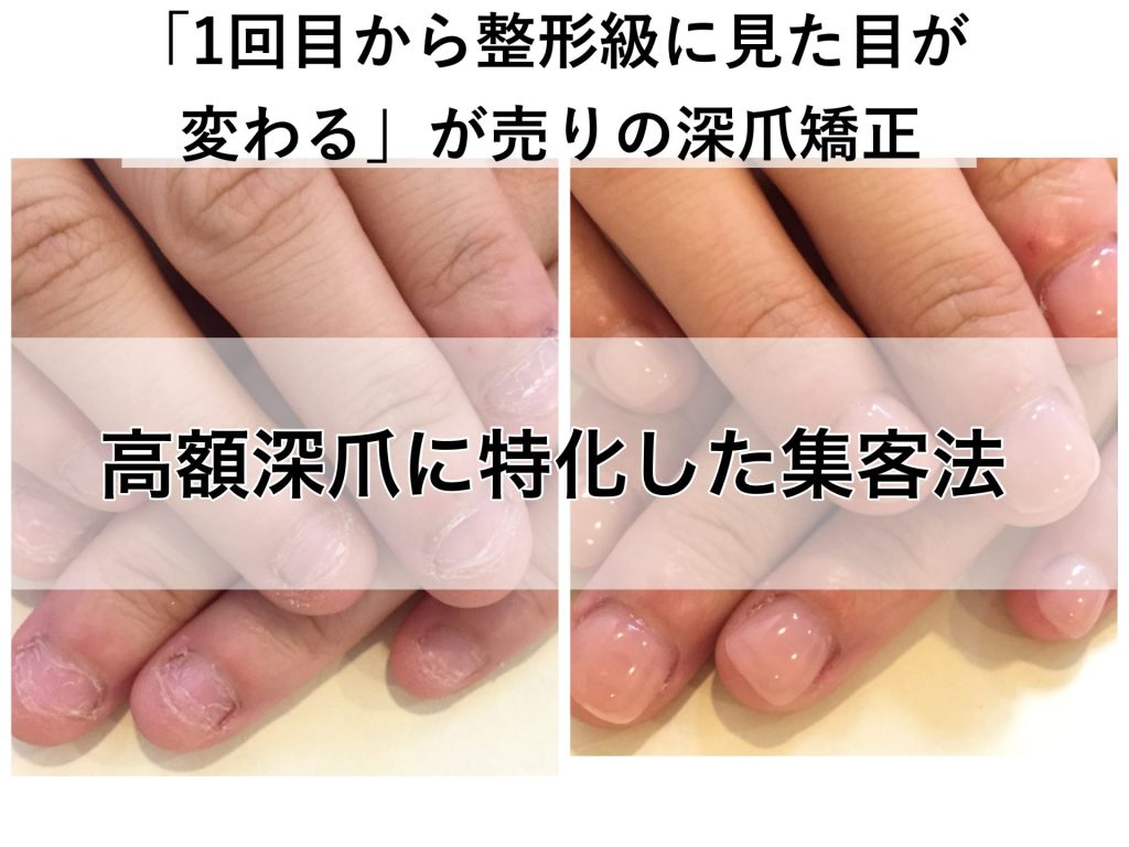 高額深爪に特化した集客法