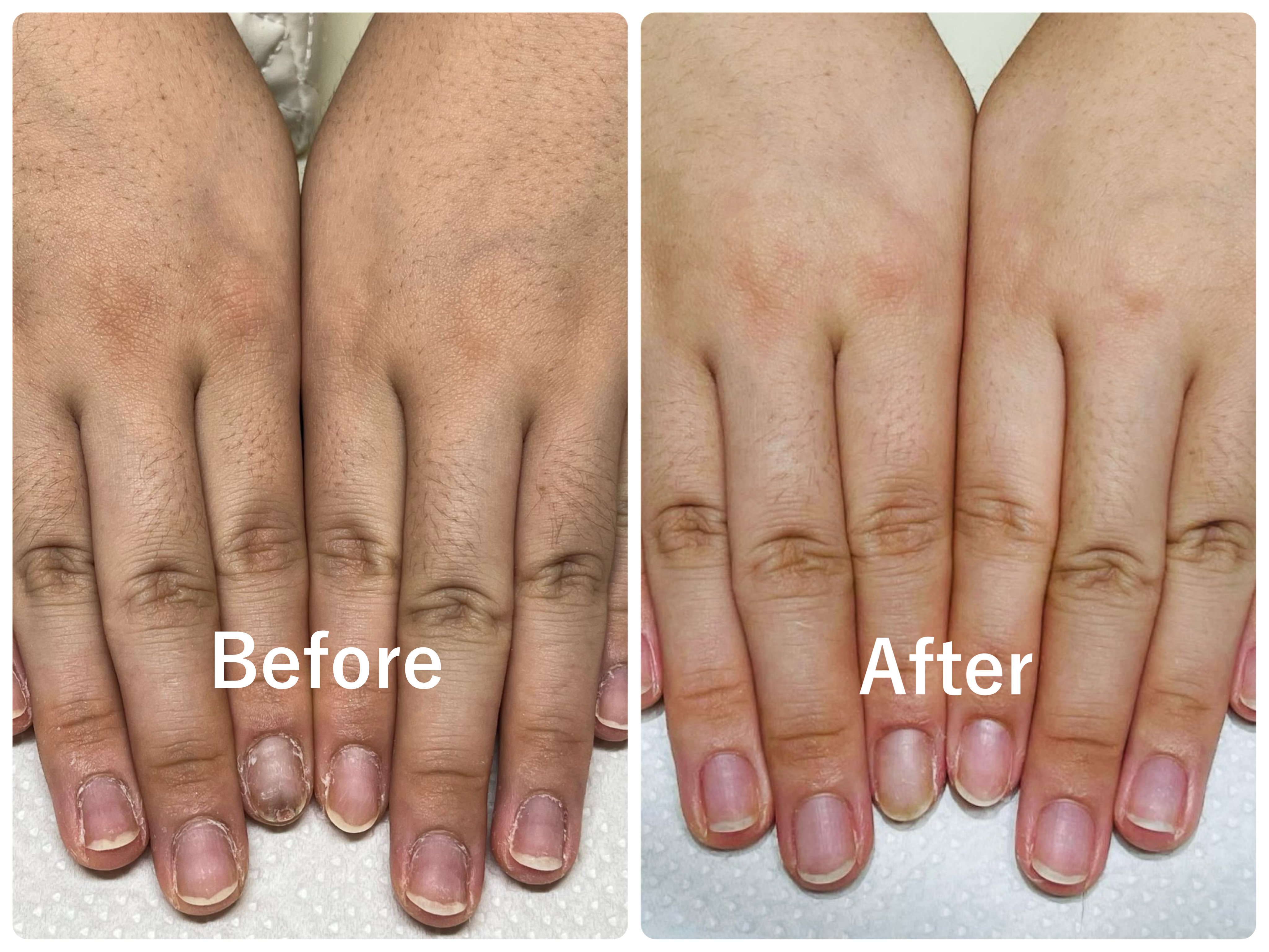 手肌再生メニュー