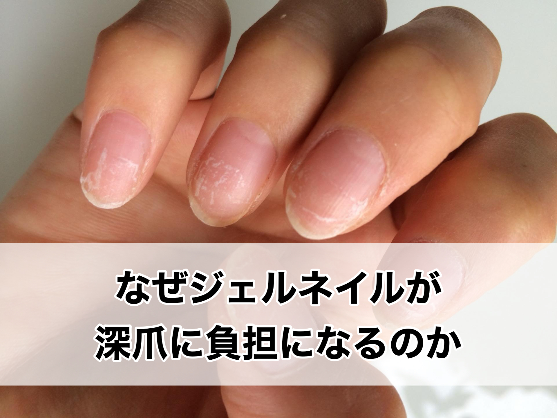 なぜジェルネイルが深爪に負担になるのか