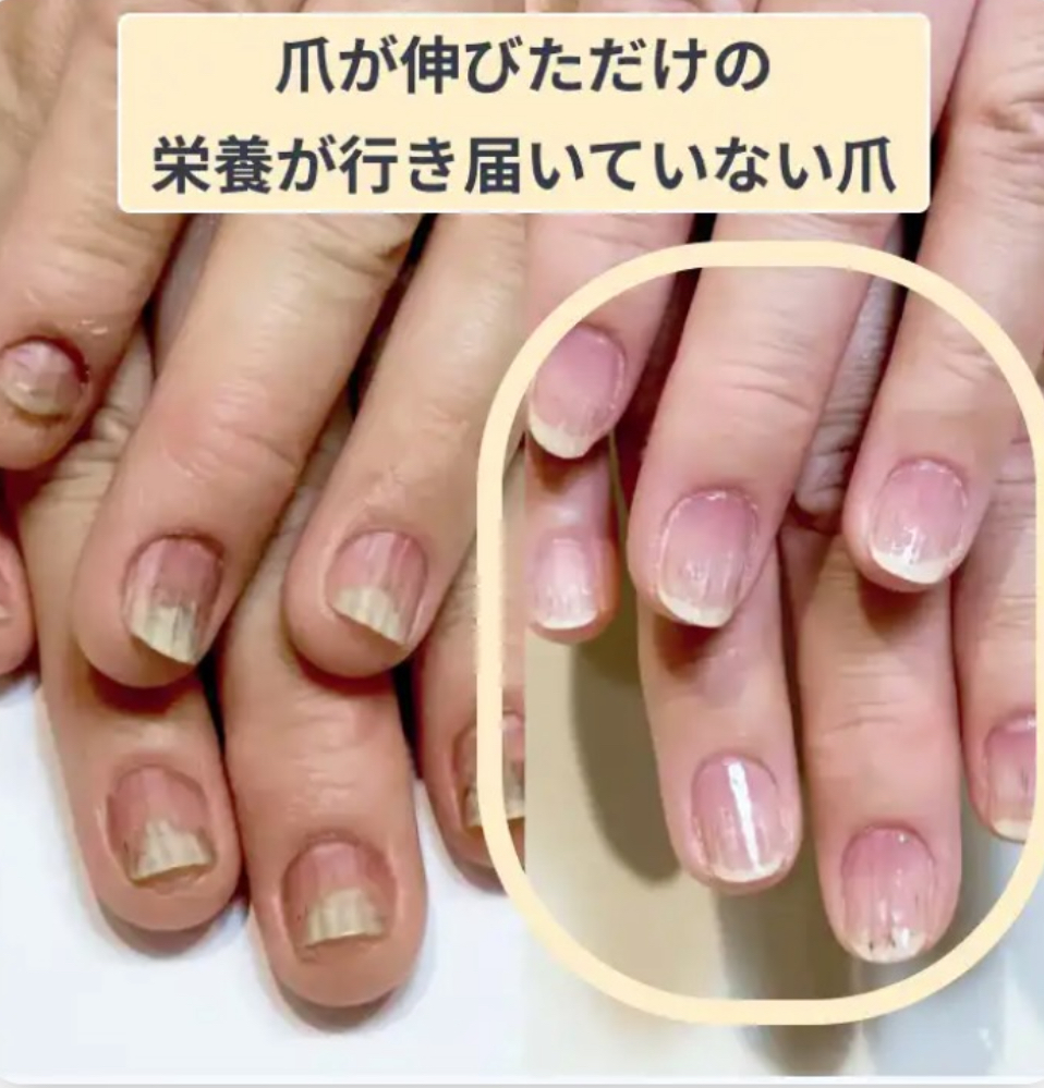爪が伸びただけの栄養が行き届いていない爪